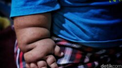 “Obesitas Sentral Menyerang Gen Alpha, Ini Peringatan Mendesak dari Kemenkes untuk anak-anak Indonesia!”