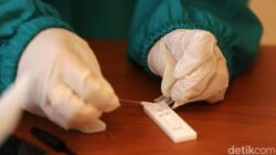 DKI Catat 35 Kasus COVID-19 di 2025, Dinkes Nilai Stabilitas Virus Turun!